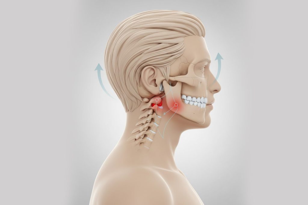jaw pain